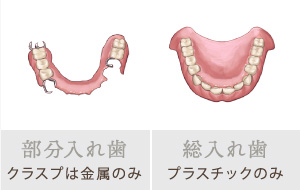 部分入れ歯（クラスプは金属のみ）、総入れ歯（プラスチックのみ）