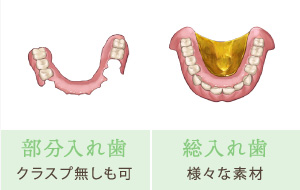 部分入れ歯（クラスプ無しも可）、総入れ歯（様々な素材）