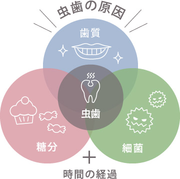 虫歯の原因＝歯質・細菌・糖分＋時間の経過